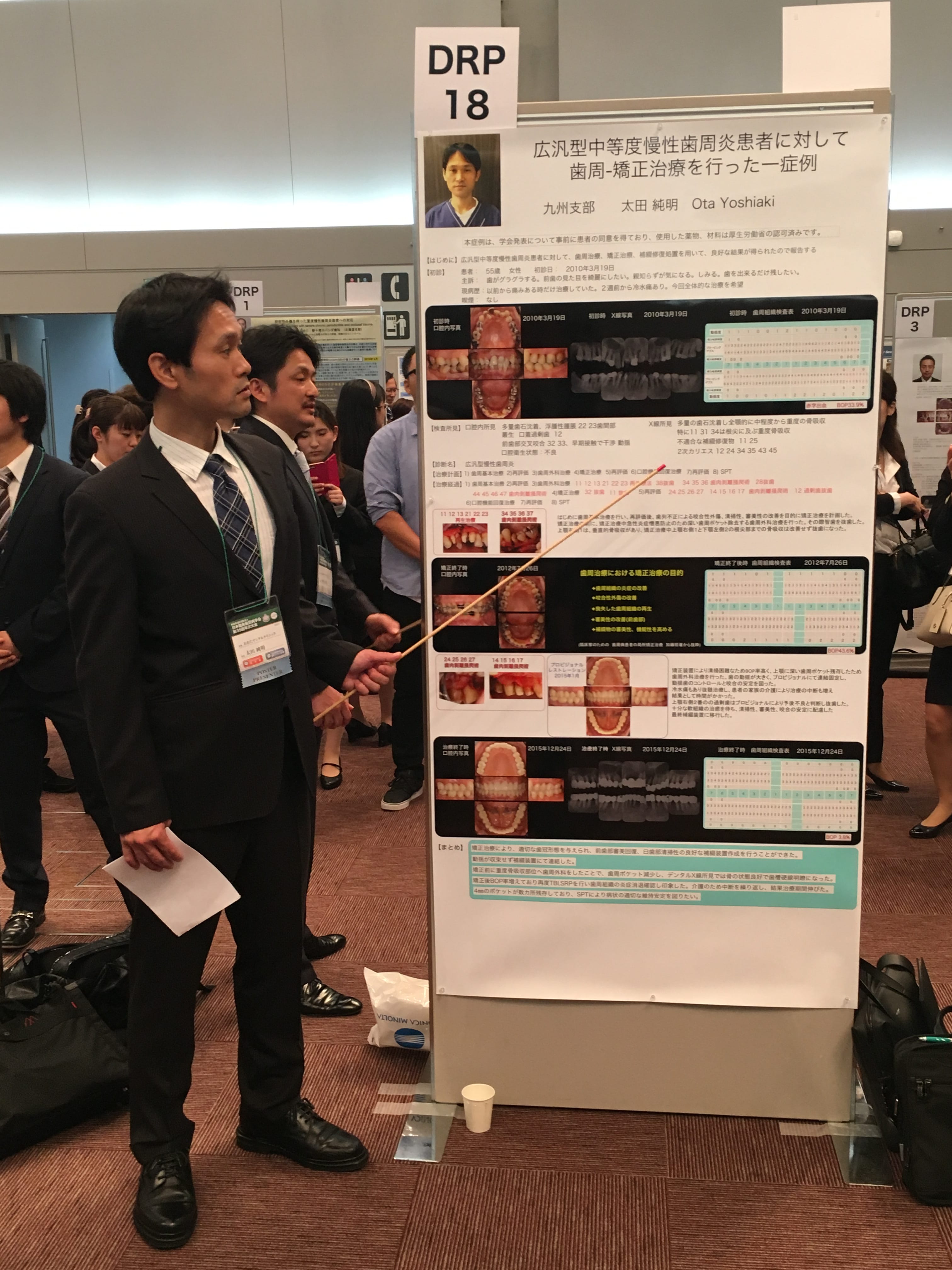 日本臨床歯周病学会　年次大会　大阪にてポスター発表しました