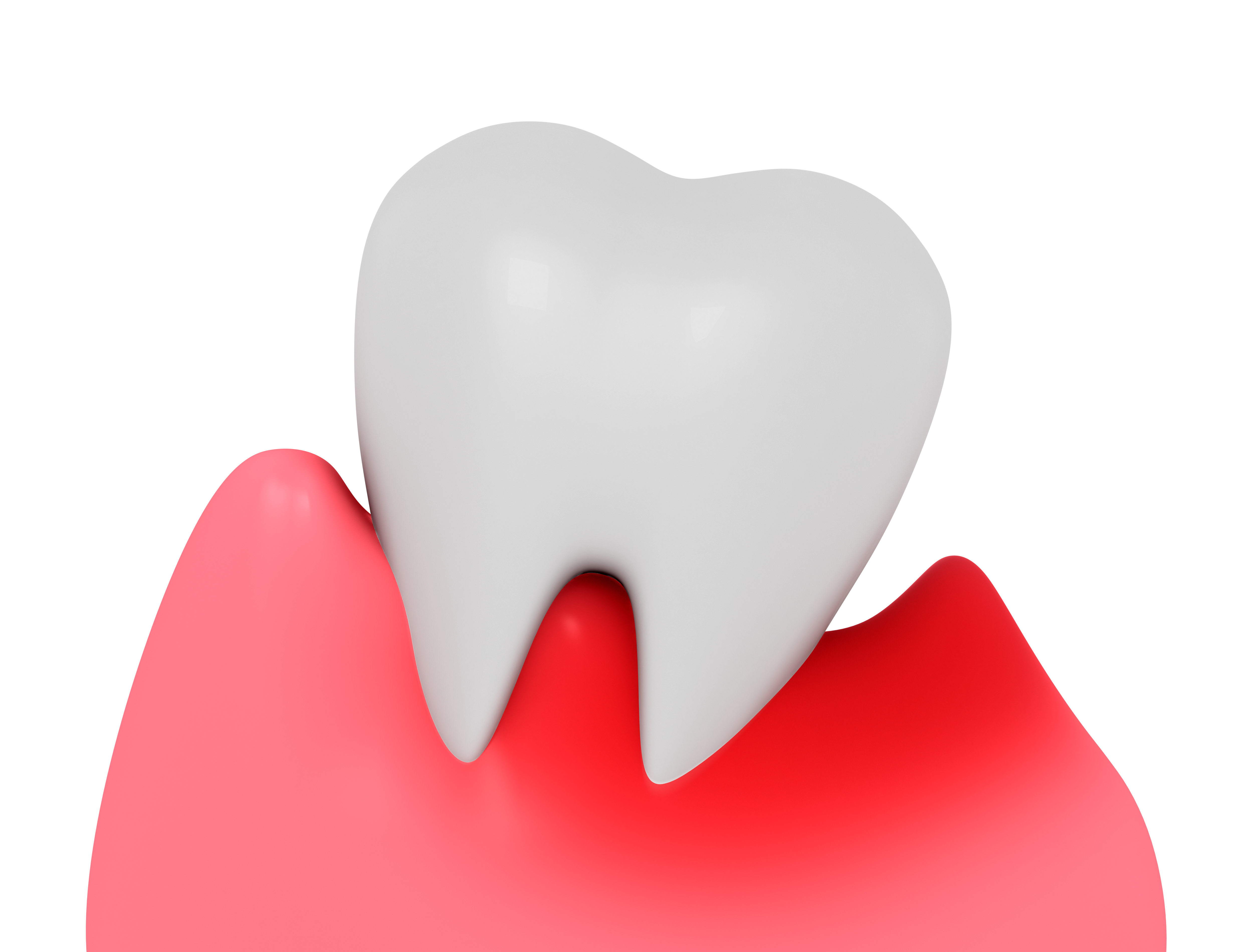 歯の健康を脅かす！黒い歯石の正体とは？
