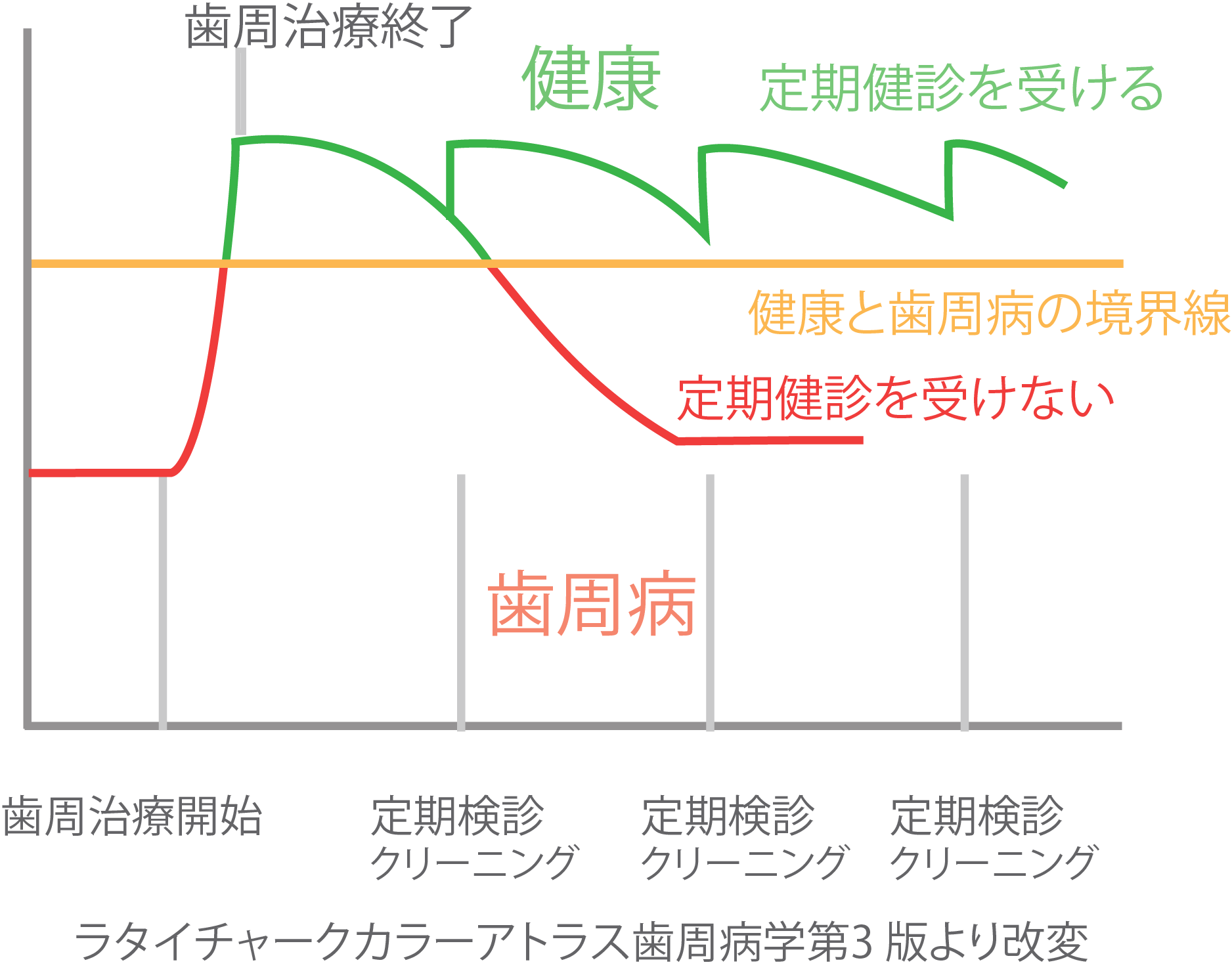 日本と世界における歯の治療の考え方の違い