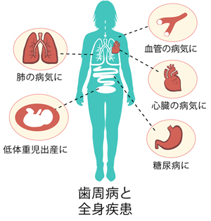 ほかにも歯周病と全身疾患について心配な報告があります